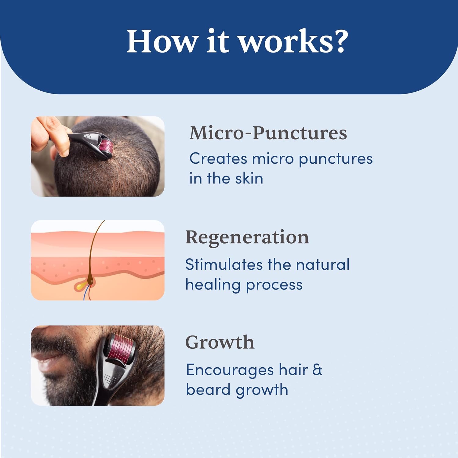 Man Matters Derma Roller with 540 Titanium Alloy Micro Needles 0.5 mm | Suitable for Beard Also | Reduces Hair Fall | Stimulates Hair Follicles | Easy to use | Safe & Effective
